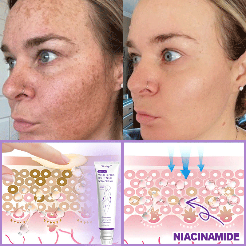 Vitalisys®💧PDRN Multi-Peptide Massaging Body Roller Cream- Anti-aging, Hydrating, Skin Firming & Lifting, Skin Repair, Even Tone, Acne and Dark Spot Treatment, Wart and Mole Removal, and Psoriasis Relief