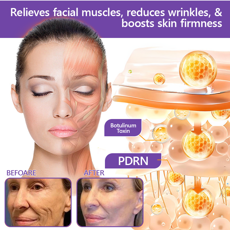 Vitalisys®💧PDRN Multi-Peptide Massaging Body Roller Cream- Anti-aging, Hydrating, Skin Firming & Lifting, Skin Repair, Even Tone, Acne and Dark Spot Treatment, Wart and Mole Removal, and Psoriasis Relief