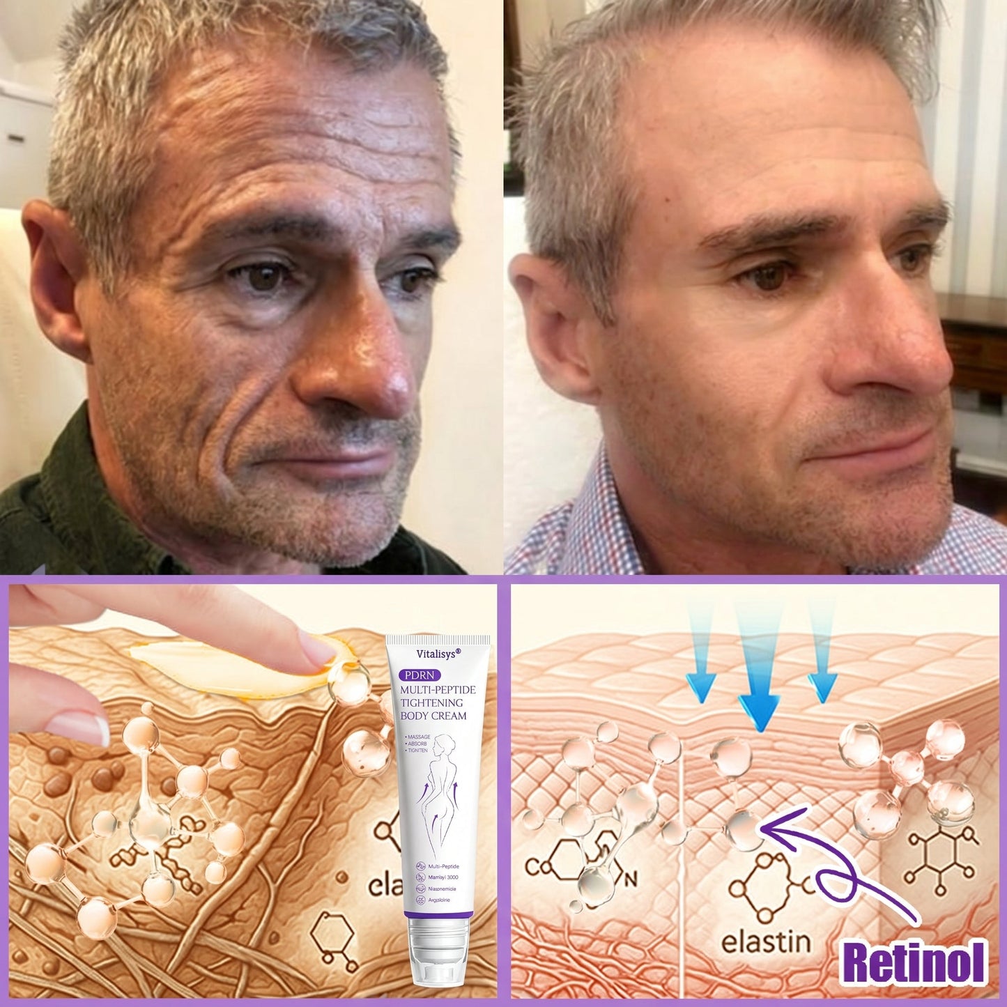 Vitalisys®💧PDRN Multi-Peptide Massaging Body Roller Cream- Anti-aging, Hydrating, Skin Firming & Lifting, Skin Repair, Even Tone, Acne and Dark Spot Treatment, Wart and Mole Removal, and Psoriasis Relief