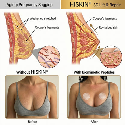 💃𝐇𝐈𝐒𝐊𝐈𝐍® 👩‍⚕️ Targeted Breast Enhancement Advanced Nano Microneedle Patch💃